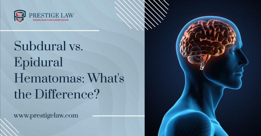 Understanding Brain Hematomas: Subdural vs. Epidural