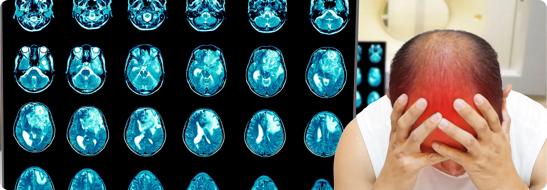 Brain Injuries