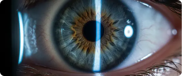 Eye Injury Lawyer in L.A